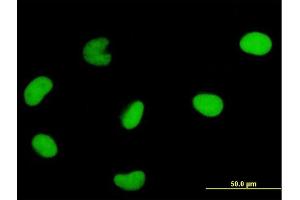 Immunofluorescence of monoclonal antibody to DUT on HeLa cell. (Deoxyuridine Triphosphatase (DUT) (AA 68-164) antibody)