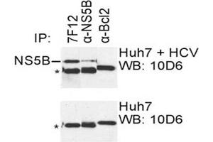 IP was carried out with NS5B specific mAb 7F12 using the lysates of Huh7 cells harboring selectable subgenomic HCV RNA replicon (upper panel) or plain Huh7 cells (lower panel). (HCV 1b NS5B antibody  (AA 77-86))
