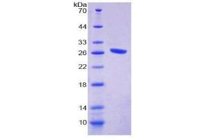 SDS-PAGE (SDS) image for Complement Component 1, Q Subcomponent, A Chain (C1QA) (AA 23-245) protein (His tag) (ABIN2124445)