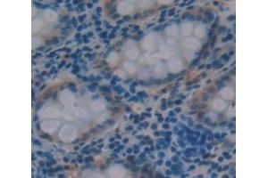 Figure. (CLCA1 antibody  (AA 416-670))