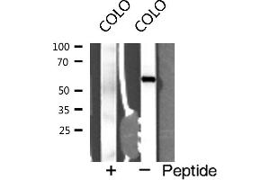 Western blot analysis of Interleukin 2 receptor β expression in COLO cells (IL2 Receptor beta antibody  (N-Term))