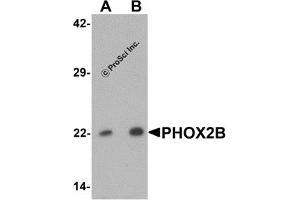 Western Blotting (WB) image for anti-Paired-Like Homeobox 2b (PHOX2B) (Middle Region) antibody (ABIN1031037) (PHOX2B antibody  (Middle Region))