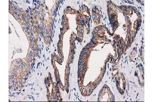 Image no. 3 for anti-Protein Kinase C and Casein Kinase Substrate in Neurons 3 (PACSIN3) antibody (ABIN1500007) (PACSIN3 antibody)