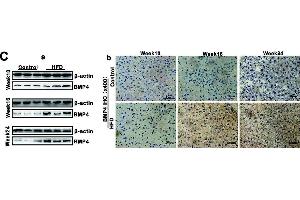 BMP4 expression is elevated during Oleic acid-induced triglyceride/lipid accumulation in hepatocytes and in a mouse model of NAFLD.