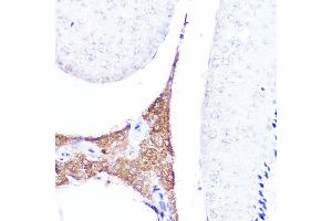 Immunohistochemistry of paraffin-embedded mouse testis using AMH Rabbit pAb (ABIN7265629) at dilution of 1:25 (40x lens). (AMH antibody  (AA 20-280))