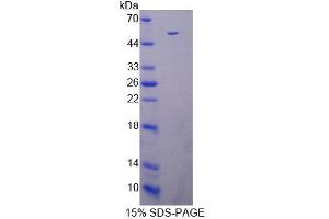 SDS-PAGE (SDS) image for Death-Associated Protein Kinase 3 (DAPK3) (AA 1-448) protein (His tag) (ABIN4990358)