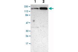 Western Blot analysis of Lane 1: RT-4 and Lane 2: U-251MG sp cell lysates with MYBBP1A polyclonal antibody .