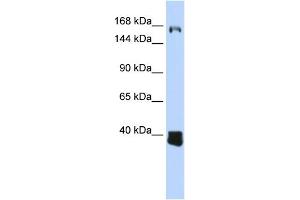WB Suggested Anti-C10orf12 Antibody Titration: 0. (Lcor antibody  (Middle Region))