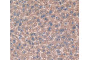 Figure. (Vitamin D-Binding Protein antibody  (AA 205-403))