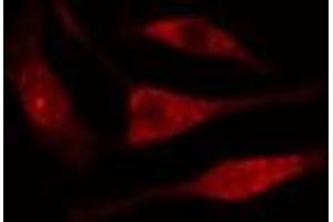 ABIN6277615 staining  Hela cells by IF/ICC. (UBD antibody  (Internal Region))