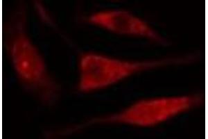 ABIN6277615 staining  Hela cells by IF/ICC.