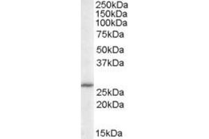 Image no. 1 for anti-Acidic (Leucine-Rich) Nuclear phosphoprotein 32 Family, Member B (ANP32B) (C-Term) antibody (ABIN374313) (ANP32B antibody  (C-Term))