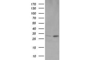 Image no. 2 for anti-OTU Domain, Ubiquitin Aldehyde Binding 1 (OTUB1) antibody (ABIN1499932) (OTUB1 antibody)