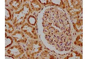 IHC image of ABIN7169084 diluted at 1:300 and staining in paraffin-embedded human kidney tissue performed on a Leica BondTM system. (PKN3 antibody  (AA 1-252))