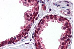 Human Prostate: Formalin-Fixed, Paraffin-Embedded (FFPE) (SERPINA3 antibody  (AA 254-303))