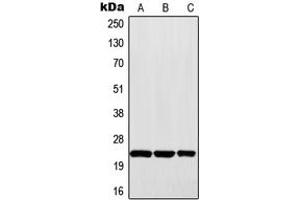 Western blot analysis of MAD2 expression in Raji (A), HepG2 (B), A431 (C) whole cell lysates. (MAD2 antibody  (Center))