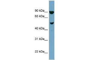 WB Suggested Anti-IRX2 Antibody Titration:  0.