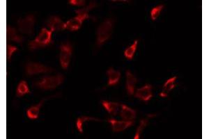 ABIN6275232 staining Hela by IF/ICC. (MRPS2 antibody  (C-Term))