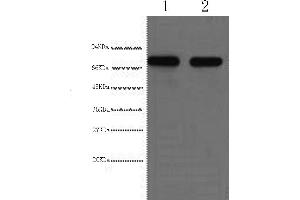 Western Blotting (WB) image for anti-alpha-Fetoprotein (AFP) antibody (ABIN5958041) (alpha Fetoprotein antibody)