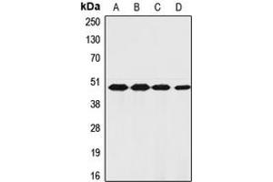 Western blot analysis of PAR1 expression in PaCa2 (A), HeLa (B), TF1 (C), ECV304 (D) whole cell lysates. (PAR1 antibody  (N-Term))