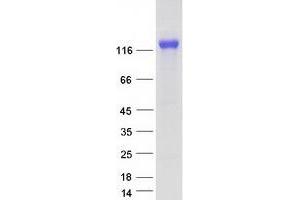 Western Blotting (WB) image for Complement Component (3d/Epstein Barr Virus) Receptor 2 (CR2) (Transcript Variant 2) protein (Myc-DYKDDDDK Tag) (ABIN2713502)