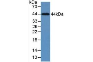 Detection of Recombinant KRT5, Human using Monoclonal Antibody to Cytokeratin 5 (CK5) (Cytokeratin 5 antibody  (AA 168-481))