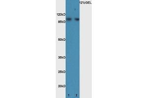 Lane 1:mouse brain lysate probed with Rabbit Anti-BMP1 Polyclonal Antibody, Unconjugated (ABIN873233) at 1:300 overnight at 4 °C. (BMP1 antibody)