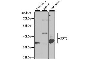 Western Blotting (WB) image for anti-Sirtuin 2 (SIRT2) (AA 288-389) antibody (ABIN3020852)