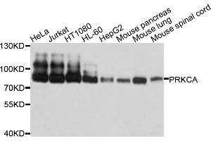 Western blot analysis of extracts of various cell lines, using PRKCA antibody. (PKC alpha antibody)
