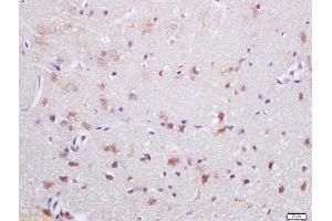 Formalin-fixed and paraffin embedded rat brain labeled with Rabbit Anti-NOX2/gp91phox Polyclonal Antibody, Unconjugated  at 1:200 followed by conjugation to the secondary antibody and DAB staining