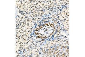 Immunohistochemistry of paraffin embedded rat ovary using Skar (ABIN7074970) at dilution of 1:900 (400x lens) (p46 antibody)