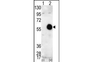 Western blot analysis of AKT2 (arrow) using AKT2 Antibody (C-term) (ABIN391022 and ABIN2841192).