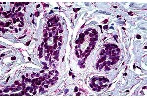 Human Breast: Formalin-Fixed, Paraffin-Embedded (FFPE) (RUNX1 antibody  (AA 210-311))