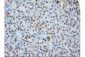 Immunohistochemical staining of paraffin-embedded Human Kidney tissue using anti-PFN1 mouse monoclonal antibody. (PFN1 antibody)