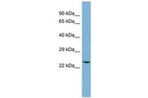 Image no. 1 for anti-Glyoxalase I (GLO1) (AA 35-84) antibody (ABIN6741835) (GLO1 antibody  (AA 35-84))