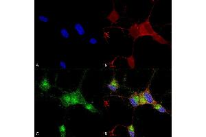 Immunocytochemistry/Immunofluorescence analysis using Mouse Anti-Nav1. (SCN9A antibody  (AA 1751-1946) (FITC))