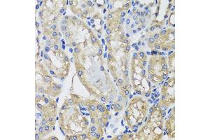 Immunohistochemistry of paraffin-embedded mouse kidney using MRPS22 antibody at dilution of 1:100 (x40 lens).