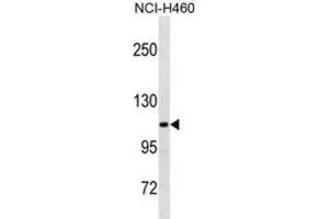 Western Blotting (WB) image for anti-Thrombospondin 4 (THBS4) antibody (ABIN3001104) (THBS4 antibody)