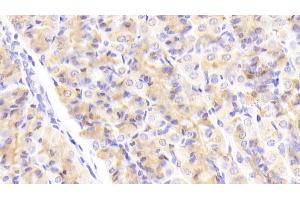 Detection of HDLBP in Human Stomach Tissue using Polyclonal Antibody to High Density Lipoprotein Binding Protein (HDLBP) (HDLBP antibody  (AA 158-371))