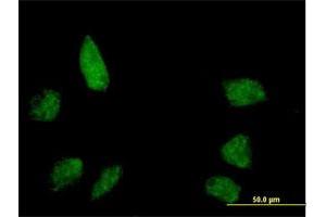 Immunofluorescence of purified MaxPab antibody to BANP on HeLa cell. (BANP antibody  (AA 1-469))