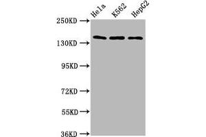 Western Blot Positive WB detected in: Hela whole cell lysate, K562 whole cell lysate, HepG2 whole cell lysate All lanes: SF3B1 antibody at 9. (SF3B1 antibody  (AA 186-378))
