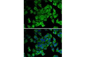 Immunofluorescence analysis of MCF7 cells using PPL antibody (ABIN6128532, ABIN6146036, ABIN6146038 and ABIN6222699).