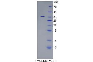 Image no. 1 for Endoplasmic Reticulum Aminopeptidase 2 (ERAP2) (AA 41-271) protein (His tag) (ABIN4990553)
