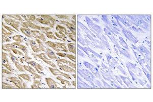 Immunohistochemistry (IHC) image for anti-Mitochondrial Ribosomal Protein L39 (MRPL39) (C-Term) antibody (ABIN1851576) (MRPL39 antibody  (C-Term))