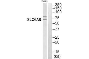 Western blot analysis of extracts from HuvEc cells, using SLC6A8 antibody. (SLC6A8 antibody  (C-Term))