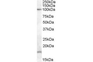 Western Blotting (WB) image for anti-Membrane-Associated Ring Finger (C3HC4) 6, E3 Ubiquitin Protein Ligase (MARCH6) (AA 701-712) antibody (ABIN303916) (MARCH6 antibody  (AA 701-712))