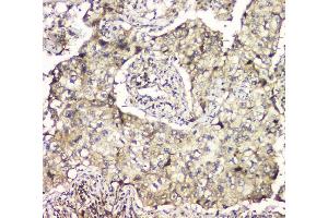 IHC analysis of MCUR1 using anti-MCUR1 antibody (ABIN6719261). (CCDC90A antibody)