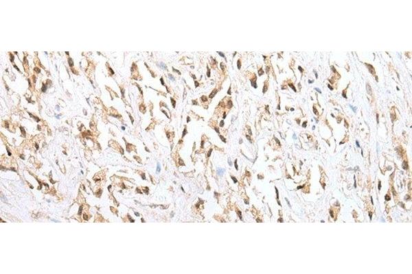 ZNF34 antibody