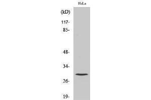 Western Blotting (WB) image for anti-Cathepsin L1 (CTSL1) (Cleaved-Thr288), (Heavy Chain) antibody (ABIN3172762) (Cathepsin L antibody  (Cleaved-Thr288, Heavy Chain))