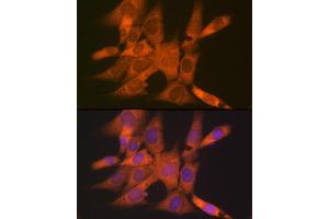 Immunofluorescence analysis of NIH-3T3 cells using CLEC3B/CLEC3B/Tetranectin Rabbit mAb (ABIN1679326, ABIN3018879, ABIN3018880 and ABIN7101681) at dilution of 1:100 (40x lens). (CLEC3B antibody)